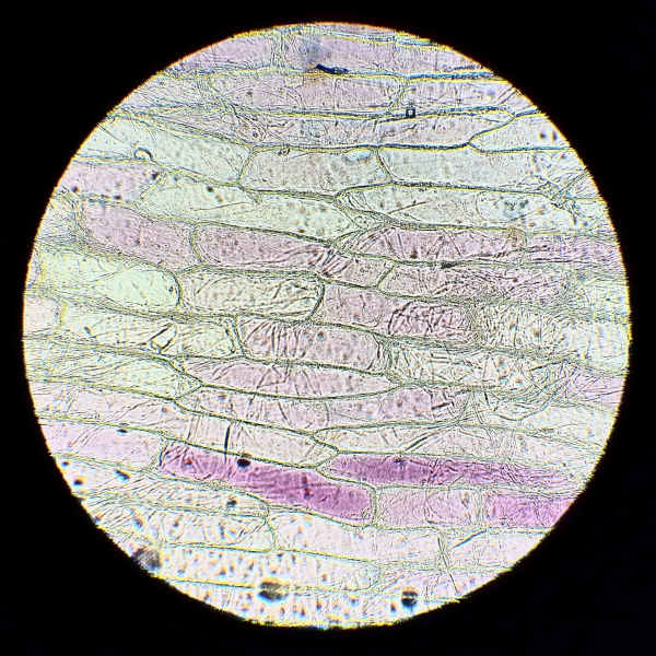 Red onion epidermal cells